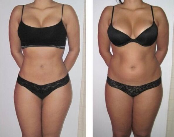 Transformation of a woman's figure after an alcoholic diet